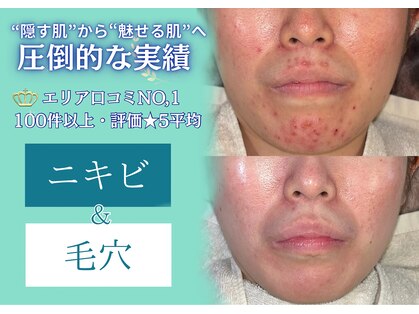 ルオン(Luon.)の写真