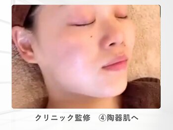 ルナティアラ(LUNAティアラ)/ピーリング中和