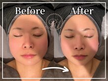 R-1ビューティーサロン 銀座/Before＆After