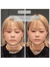 サリエ(S'allier)/お客様のビフォーアフター