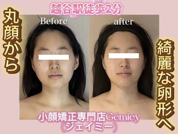 ジェイミー(Gemiey)/丸顔どこに行ったの！？