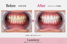 ルミエール 朝霧(Lumiere)