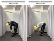ナオル整体 千葉駅店(NAORU整体)/Before After【前屈動作】