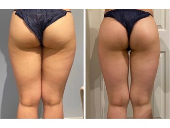 ルナグランデ(Luna grande.)/足の間に隙間を作ろう!