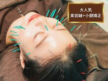 ビアンカ 目黒本院(Bianca)の雰囲気（美容鍼+小顔矯正の相性◎[目黒/肩こり/骨盤/鍼灸/矯正/整体]）