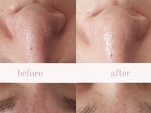 フォトギャラリー、サロンInstagramにてbeforeafter掲載中♪