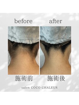 ココ シャルール(salon COCO CHALEUR)/Before　After