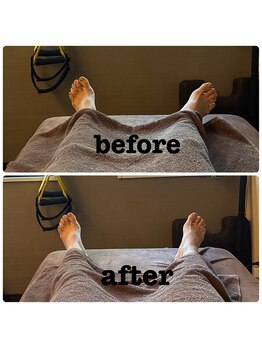 テイクオフ(Takeoff)/足元の開きからみる全身の不調