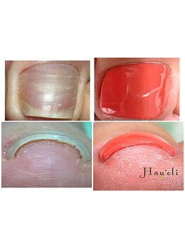 爪の悩みを解消できる（ケア含む）