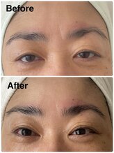 クラッシー 本八幡(CLASSY+)/光フェイシャルエステ