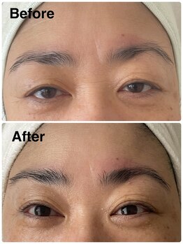 クラッシー 本八幡(CLASSY+)/光フェイシャルエステ