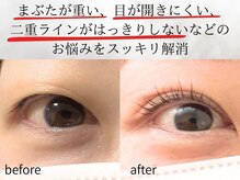 マーブル(marble)