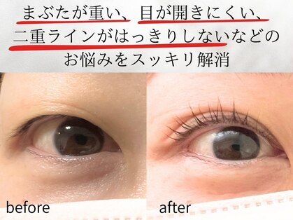 マーブル(marble)の写真