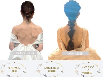 シェア 人形町店(Chare)/ブライダル/肩甲骨/姿勢/痩身