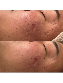 ビュウナ 銀座(BEAUNA)/ポテンザ