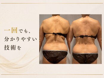 一花/オーダーメイドでしっかりプラン