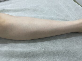 ナノハナ/鹿沼市全身脱毛美容室ナノハナ