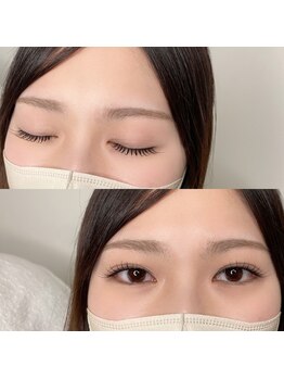 イチ(ichi)/エクステ