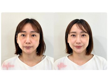 スタイルキューピット(style cupit)/メイクビフォアフター＊30代