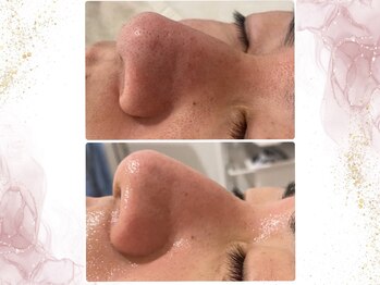 ウェリナポノビューティサロン(welina pono beauty salon)/《小顔/毛穴/脱毛》