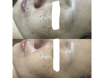 リスール(Re’seule)/SR光フォト