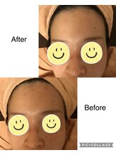 フェリース鍼灸院/