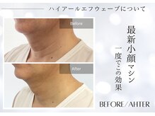 ユアーズ ビューティー(YOURS beauty)/理想の韓国Vリフトに☆