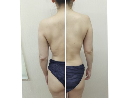 ラボーテ(La Beaute)の写真