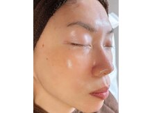 サロン ベレ プー(Salon Belle Peau)