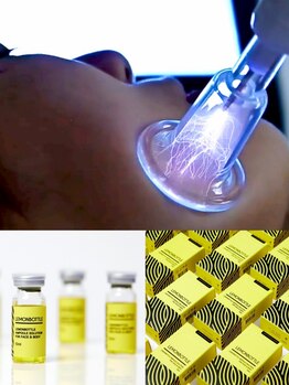 小顔になりたい