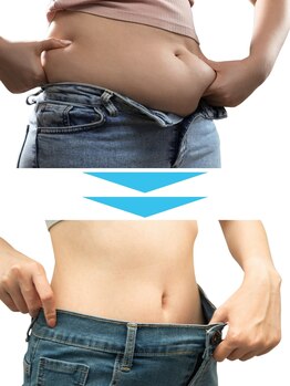 サイズダウンを目指したい