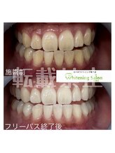 ホワイトニングサロン 札幌店/【ホワイトニングスタッフ】