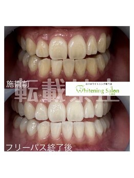 ホワイトニングサロン 札幌店/【ホワイトニングスタッフ】