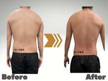 メディカルエステサロン ローズ 金沢本店(ROSE)/メンズ痩身ビフォーアフター