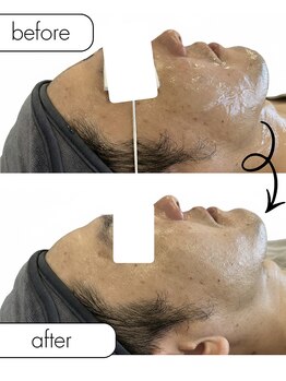 トッコ 清澄白河店(tocco)/BBL