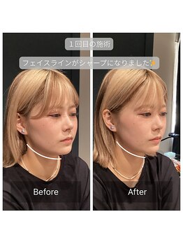 サリエ(S'allier)/お客様のビフォーアフター