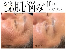 スポット 薬院駅前店(SPOT)の雰囲気（福岡市薬院の脱毛サロンでシワや開き毛穴の原因を見極めたケア）