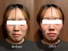 【顔のむくみや歪みが気になる方に】姿勢から整える小顔整体60分