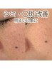 【人気セット★】肌質改善を定着させるハーブピーリング2回体験