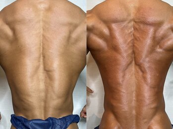 フィートウォーマー(Feet Warmer)/ジュラシック筋膜リリース1