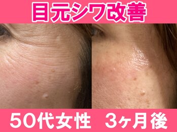 ユリシード 大阪分院(Ulyseeed)/目元が気になるなら、すぐに！
