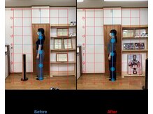 整体院輝/ビフォーアフター