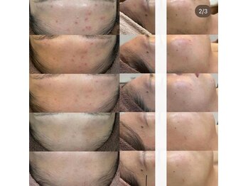 エステティック レイビス 八戸店(RAYVIS)/リアボーテタラソトリートメント