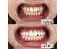 プレミアムコース3回目後