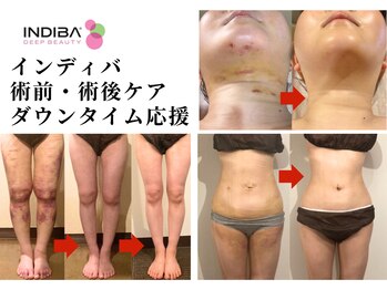 アミュレット 京都(amulette)