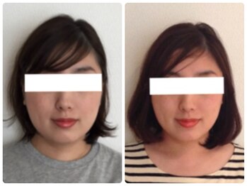 美容整体ウェリナ 名駅院/小顔矯正/骨盤矯正/美脚サロン