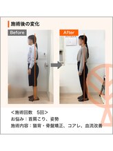 ただき接骨院 整体院 高関院/お悩み：首肩こり、姿勢