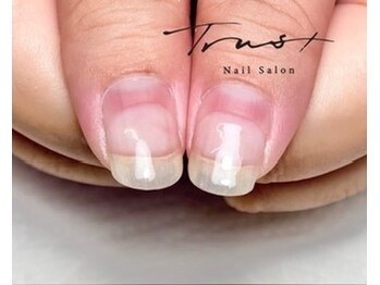 トラストネイル 佐野店(TRUST Nail)/お戻り5週間