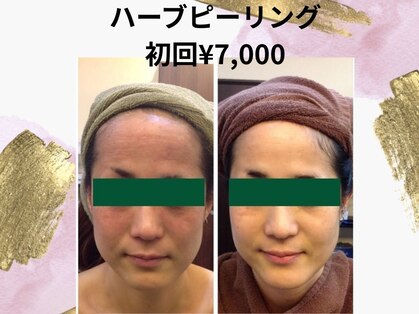 エステサロン プラスエー(+A)の写真