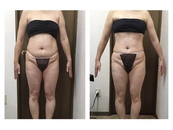 マッチ(much)/腹筋形成マシーン